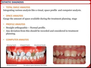 66
ESTHETIC DIAGNOSIS
• TOTAL SMILE ANALYSIS
Integrating various analysis like a visual, space profile and computer analysis.
• SPACE ANALYSIS
Gauge the amount of space available during the treatment planning stage
• PROFILE ANALYSIS
 Straight orthognathic – Normal profile.
 Any deviation from this should be recorded and considered in treatment
planning.
• COMPUTER ANALYSIS
 