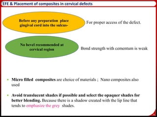 78
EFE & Placement of composites in cervical defects
For proper access of the defect.
Bond strength with cementum is weak
 Micro filled composites are choice of materials ; Nano composites also
used
 Avoid translucent shades if possible and select the opaquer shades for
better blending. Because there is a shadow created with the lip line that
tends to emphasize the grey shades.
82
Before any preparation place
gingival cord into the sulcus-
No bevel recommended at
cervical region
 