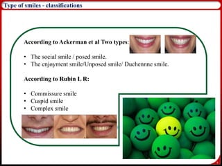 9
Type of smiles - classifications
According to Ackerman et al Two types:
• The social smile / posed smile.
• The enjoyment smile/Unposed smile/ Duchennne smile.
According to Rubin L R:
• Commissure smile
• Cuspid smile
• Complex smile
 