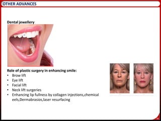 98
OTHER ADVANCES
Dental jewellery
Role of plastic surgery in enhancing smile:
• Brow lift
• Eye lift
• Facial lift
• Neck lift surgeries
• Enhancing lip fullness by collagen injections,chemical
eels,Dermabrasios,laser resurfacing
 