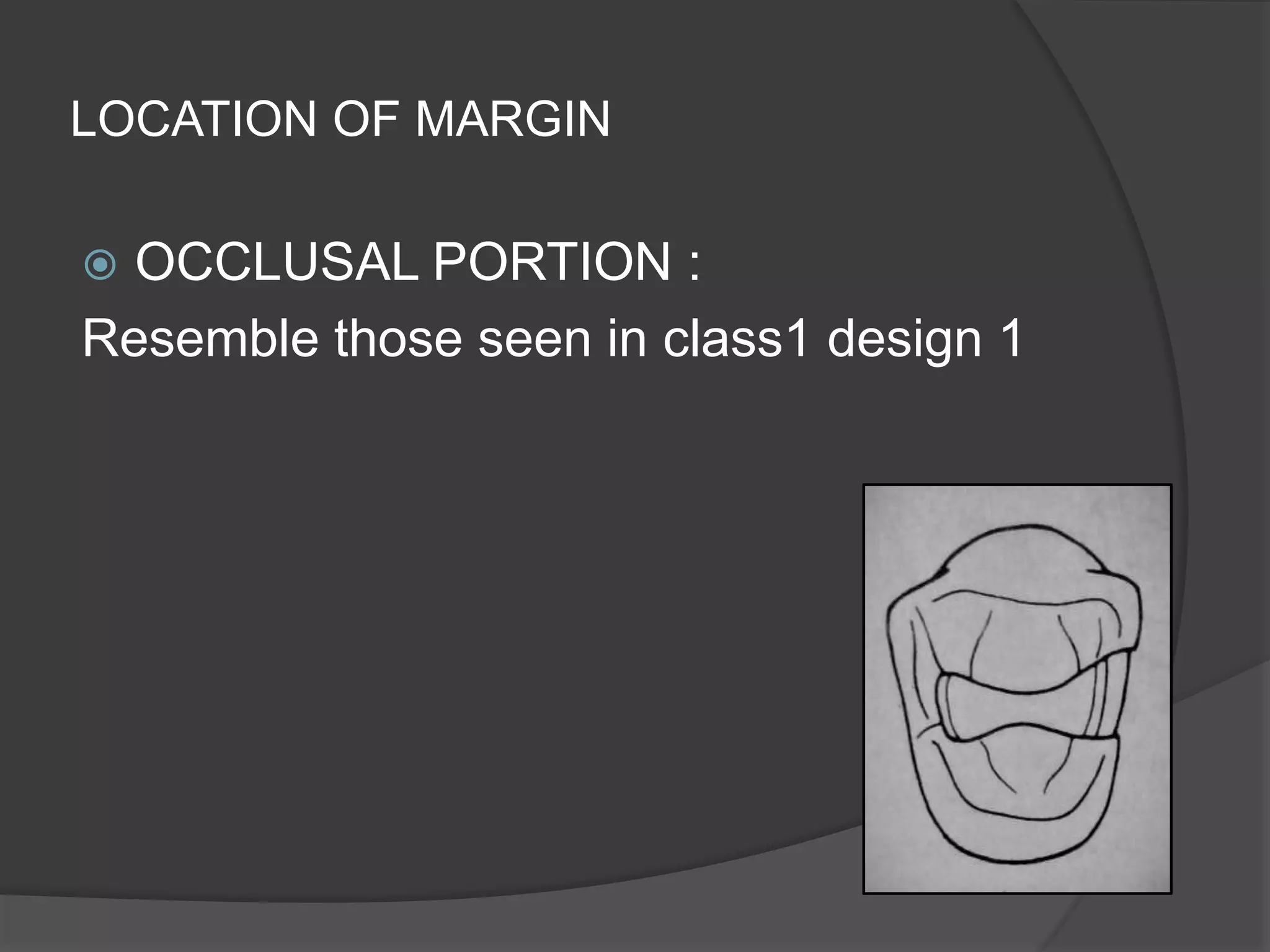 LOCATION OF MARGIN 
 OCCLUSAL PORTION : 
Resemble those seen in class1 design 1 
 