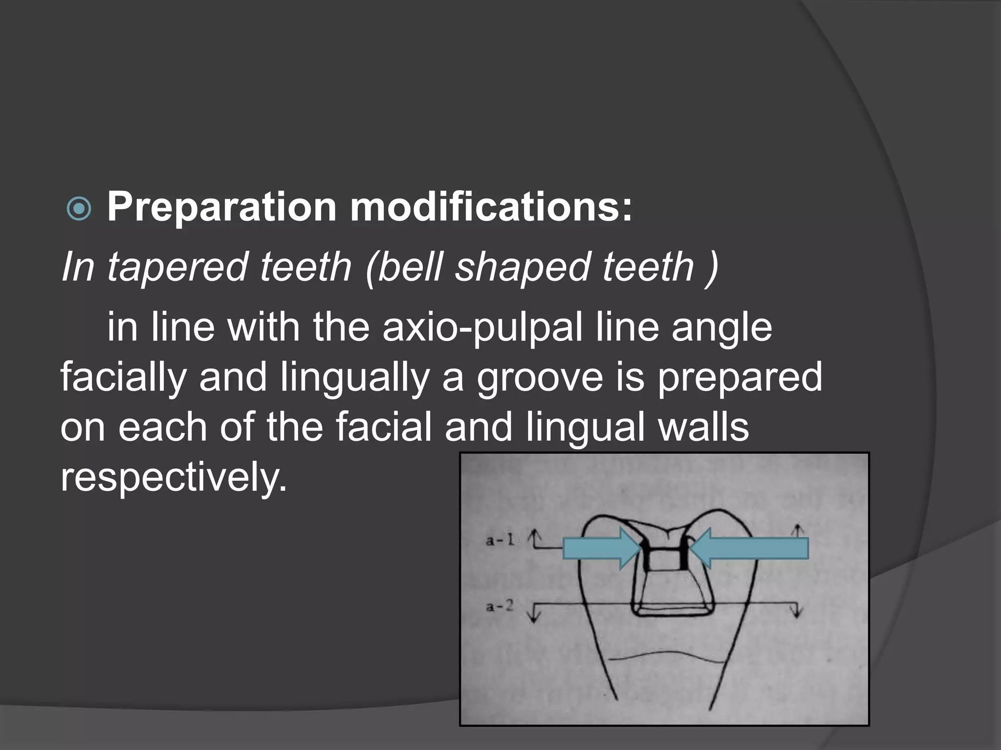  Preparation modifications: 
In tapered teeth (bell shaped teeth ) 
in line with the axio-pulpal line angle 
facially and lingually a groove is prepared 
on each of the facial and lingual walls 
respectively. 
 