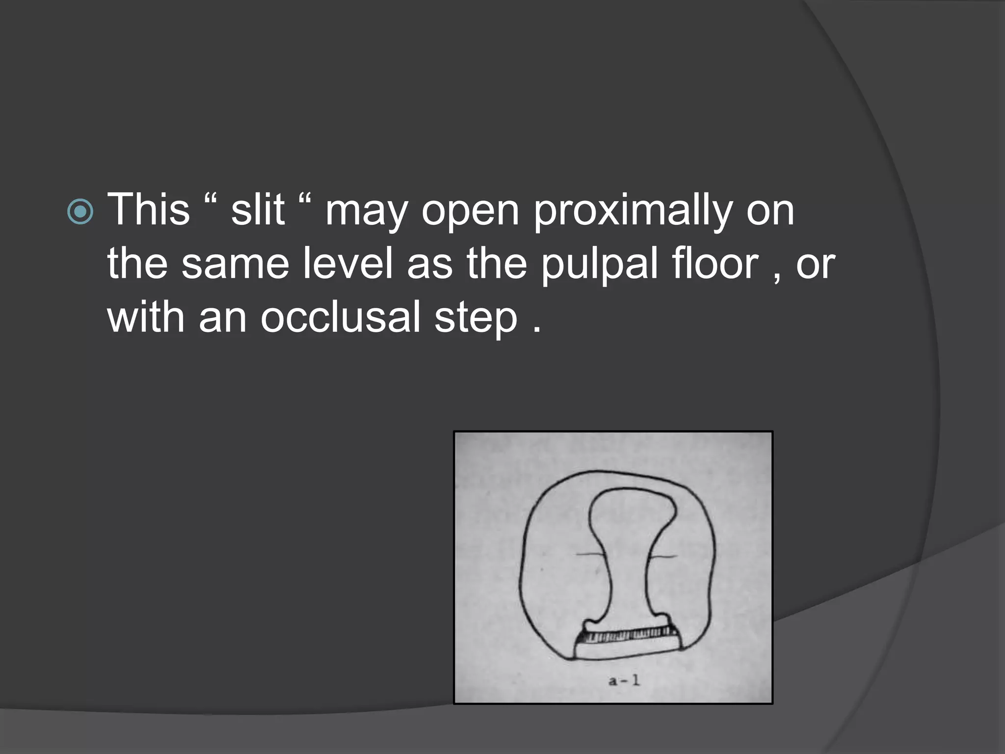  This “ slit “ may open proximally on 
the same level as the pulpal floor , or 
with an occlusal step . 
 