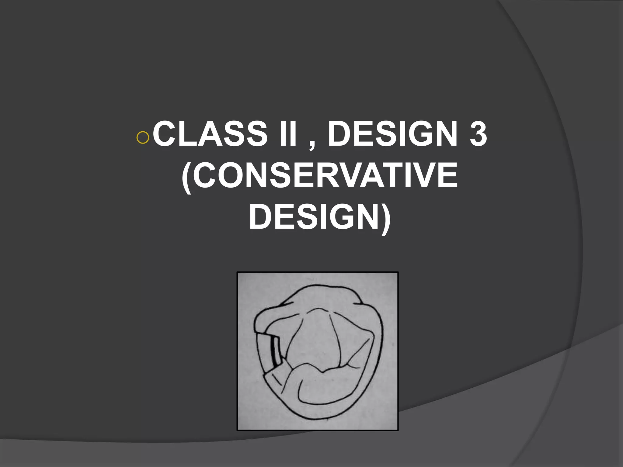 ○CLASS II , DESIGN 3 
(CONSERVATIVE 
DESIGN) 
 