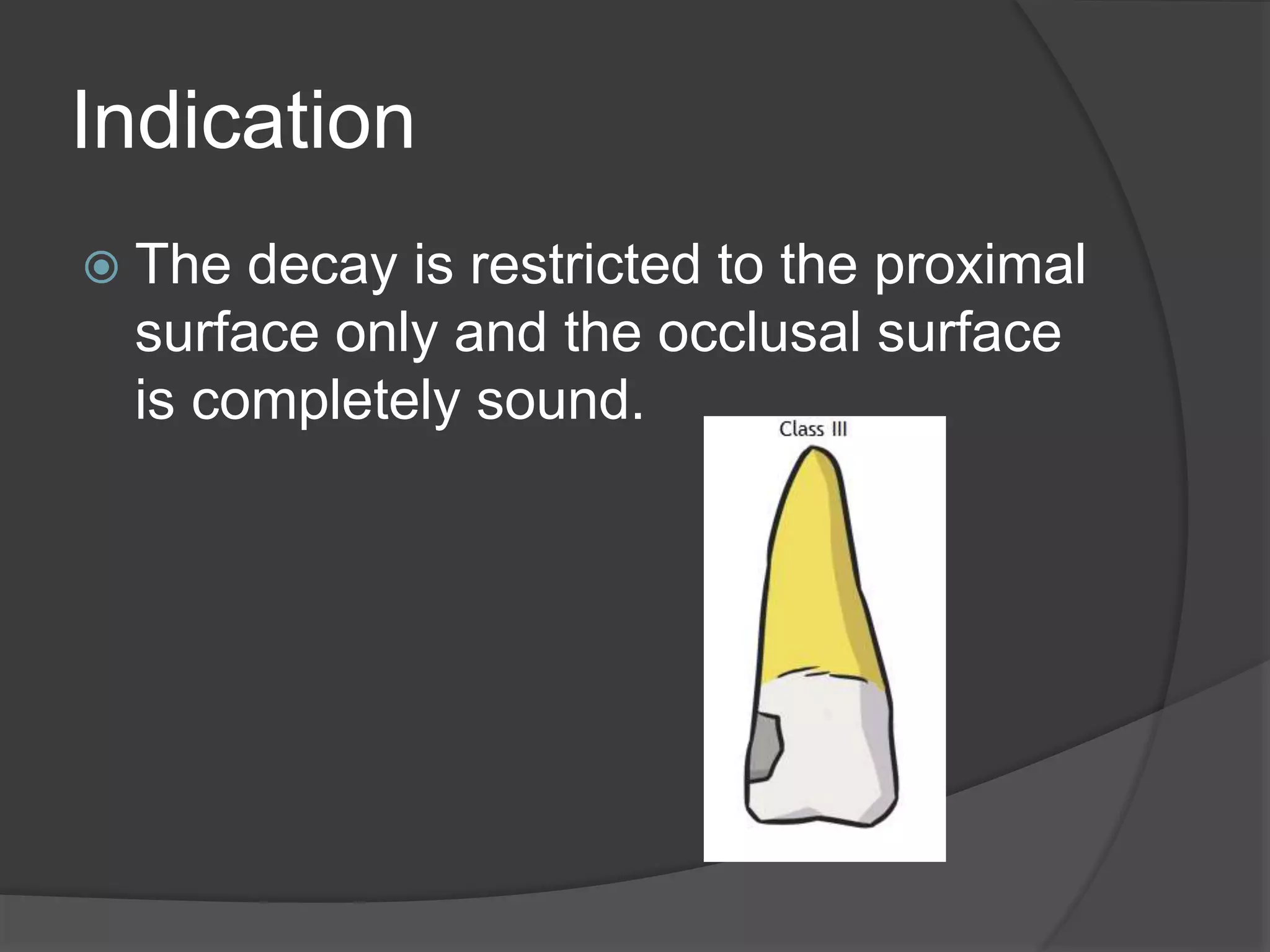 Indication 
 The decay is restricted to the proximal 
surface only and the occlusal surface 
is completely sound. 
 