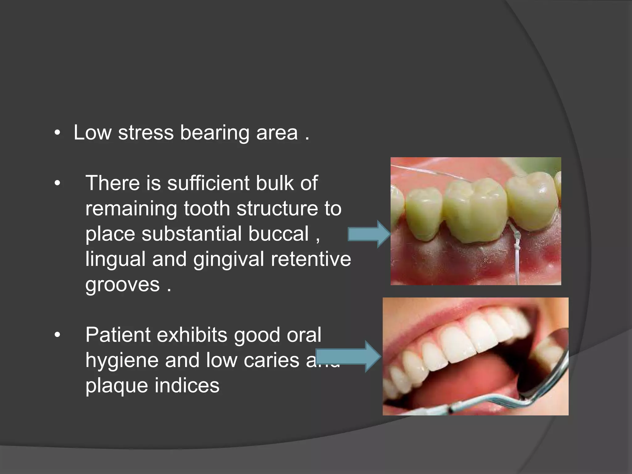 • Low stress bearing area . 
• There is sufficient bulk of 
remaining tooth structure to 
place substantial buccal , 
lingual and gingival retentive 
grooves . 
• Patient exhibits good oral 
hygiene and low caries and 
plaque indices 
 