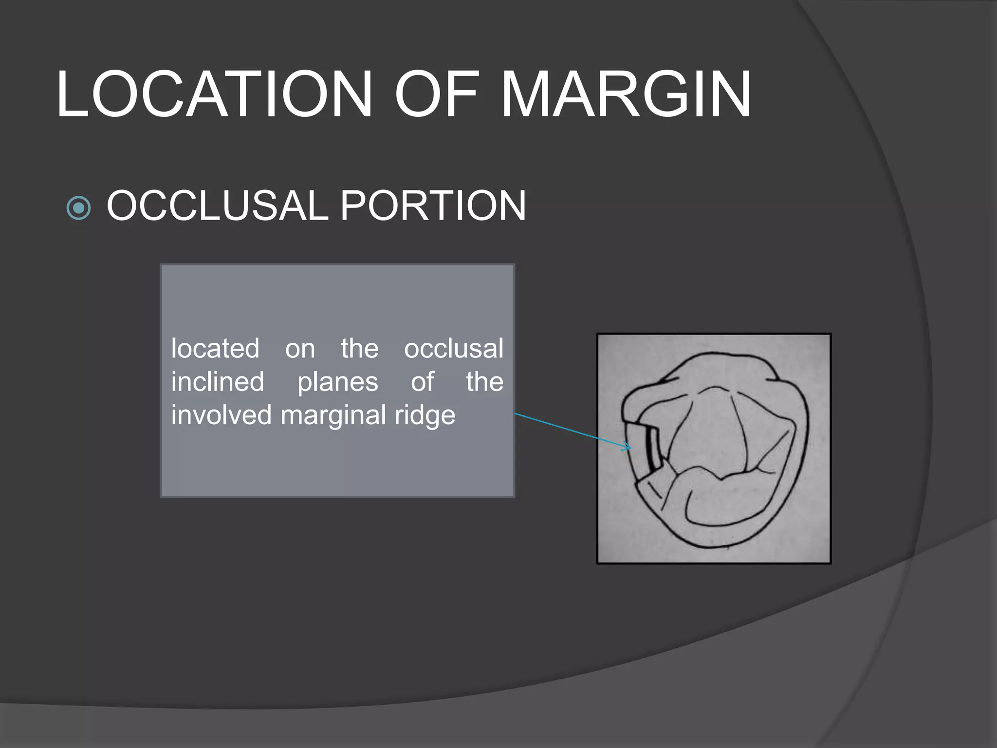 LOCATION OF MARGIN 
 OCCLUSAL PORTION 
located on the occlusal 
inclined planes of the 
involved marginal ridge 
 
