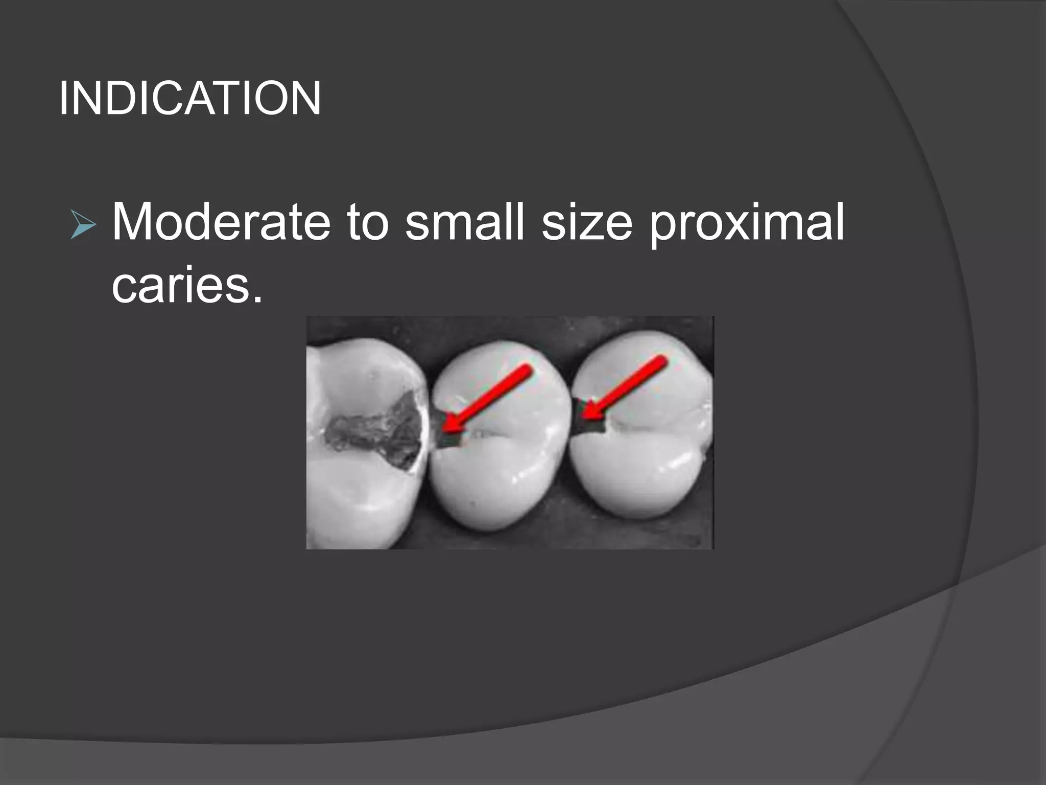 INDICATION 
 Moderate to small size proximal 
caries. 
 