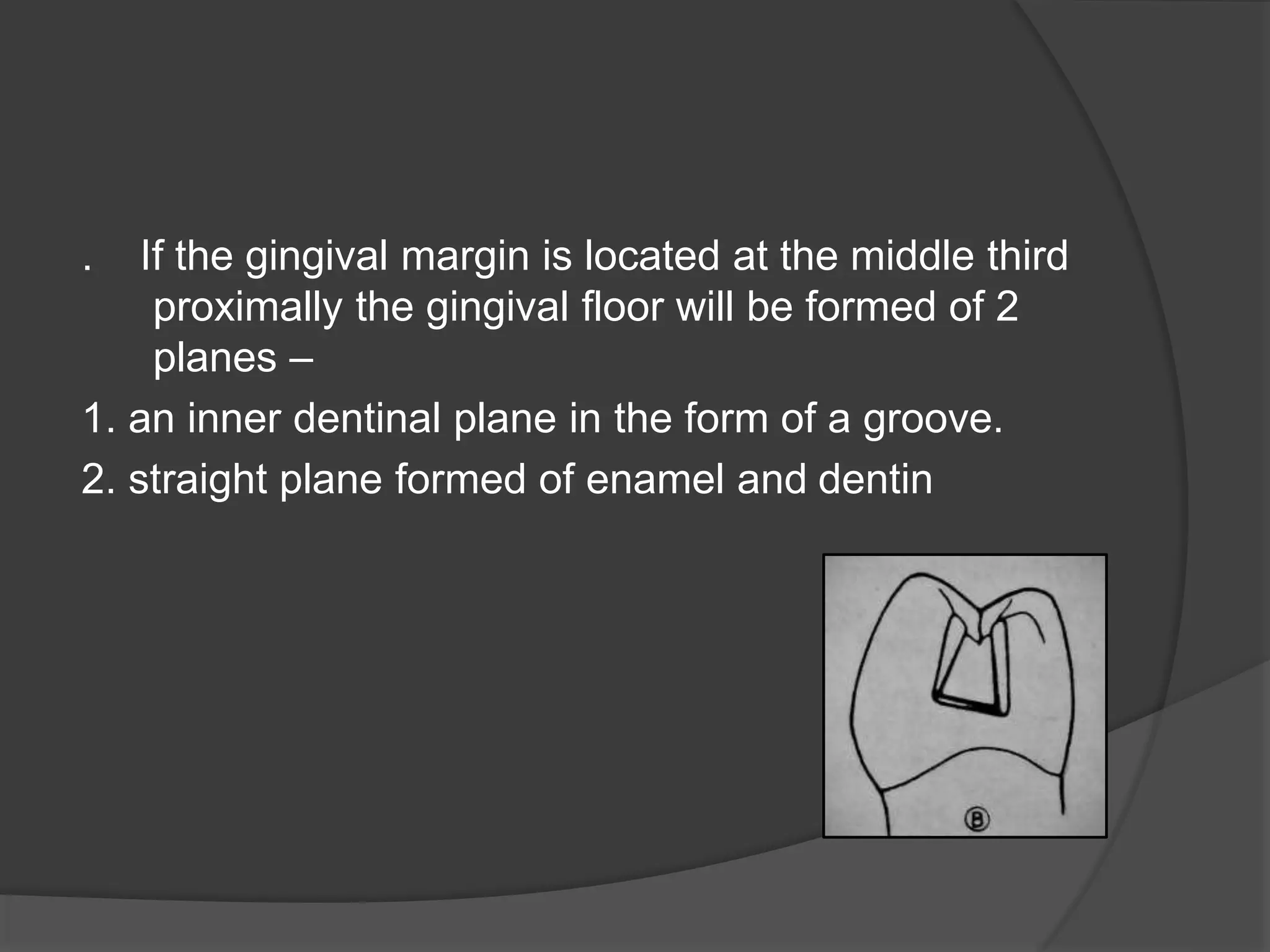 . If the gingival margin is located at the middle third 
proximally the gingival floor will be formed of 2 
planes – 
1. an inner dentinal plane in the form of a groove. 
2. straight plane formed of enamel and dentin 
 