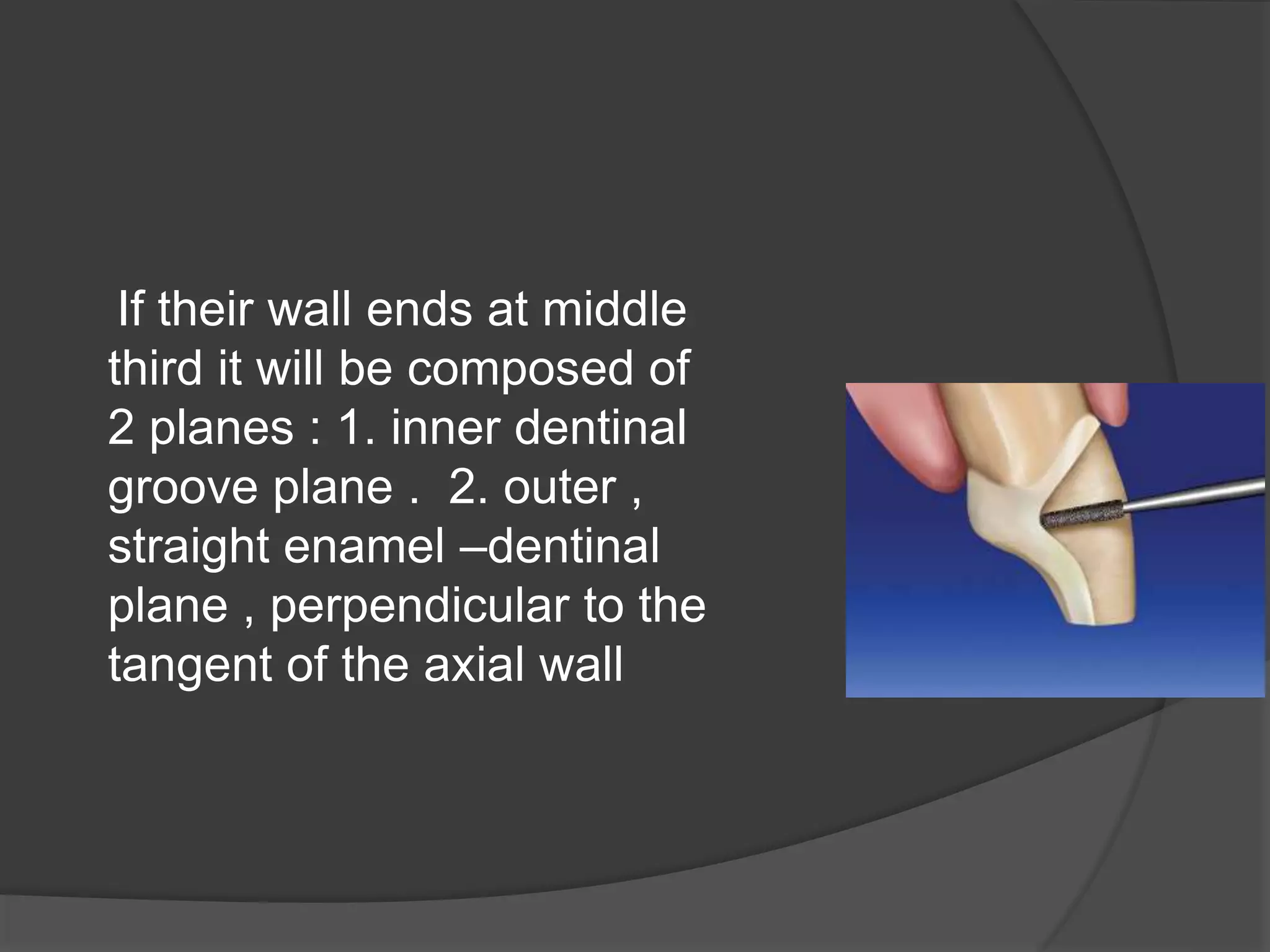 If their wall ends at middle 
third it will be composed of 
2 planes : 1. inner dentinal 
groove plane . 2. outer , 
straight enamel –dentinal 
plane , perpendicular to the 
tangent of the axial wall 
 