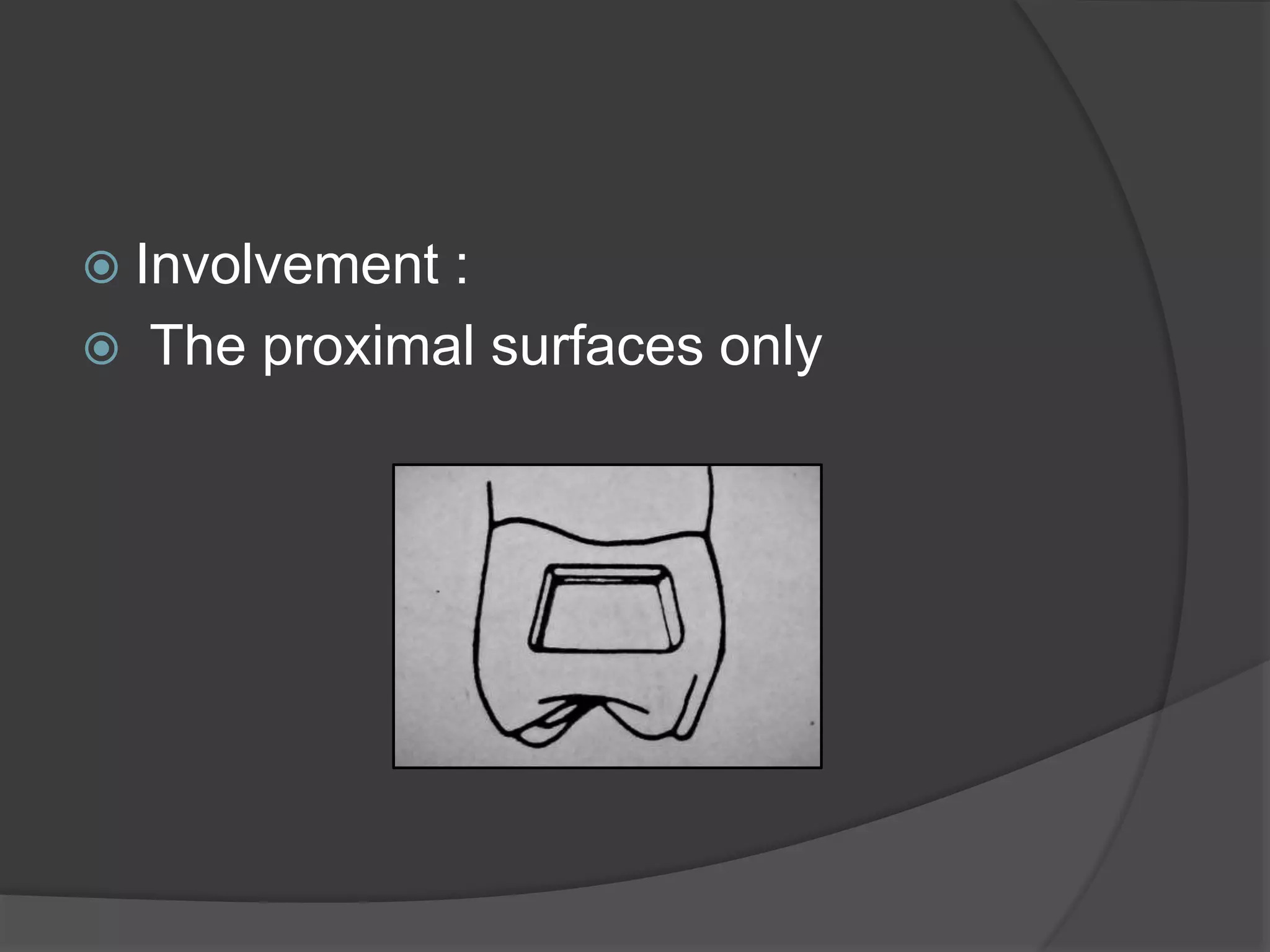  Involvement : 
 The proximal surfaces only 
 