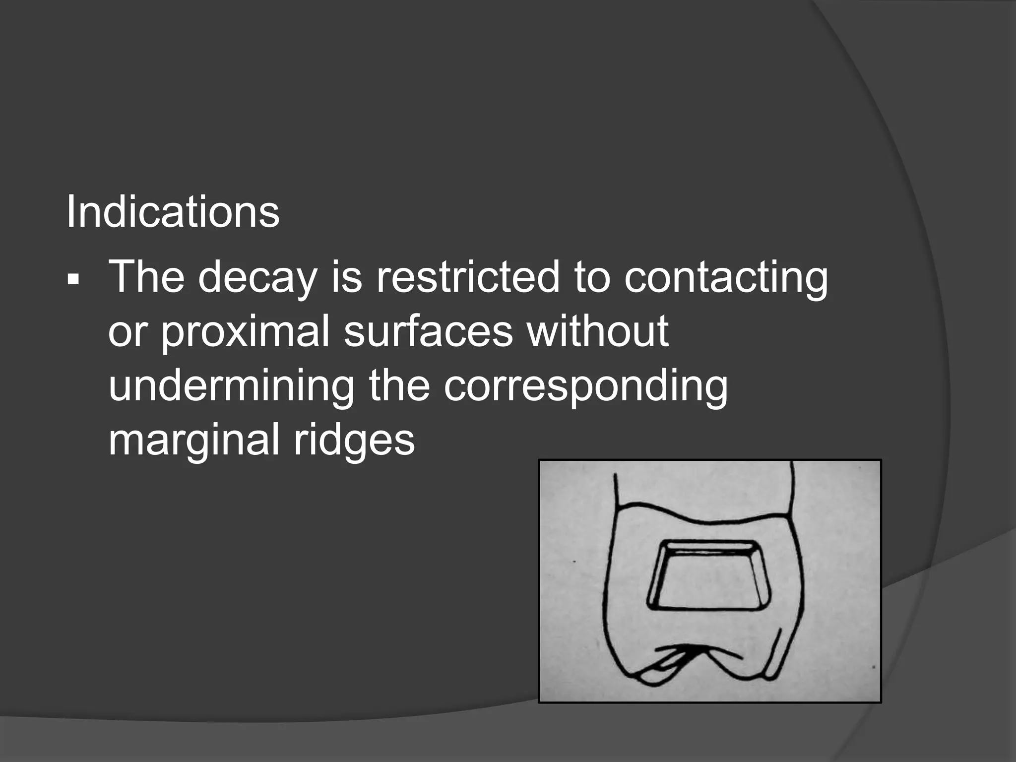 Indications 
 The decay is restricted to contacting 
or proximal surfaces without 
undermining the corresponding 
marginal ridges 
 