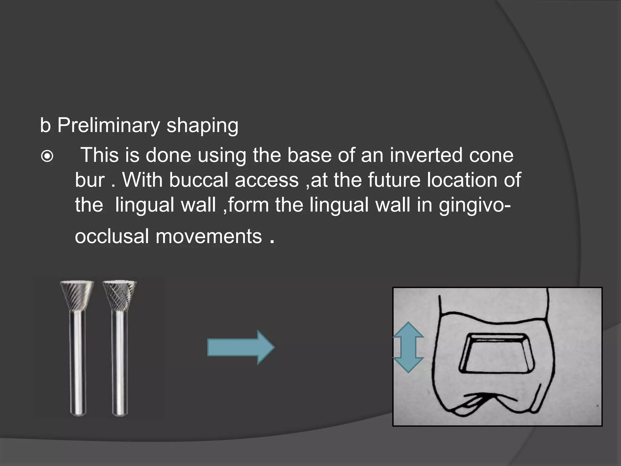 b Preliminary shaping 
 This is done using the base of an inverted cone 
bur . With buccal access ,at the future location of 
the lingual wall ,form the lingual wall in gingivo-occlusal 
movements . 
 