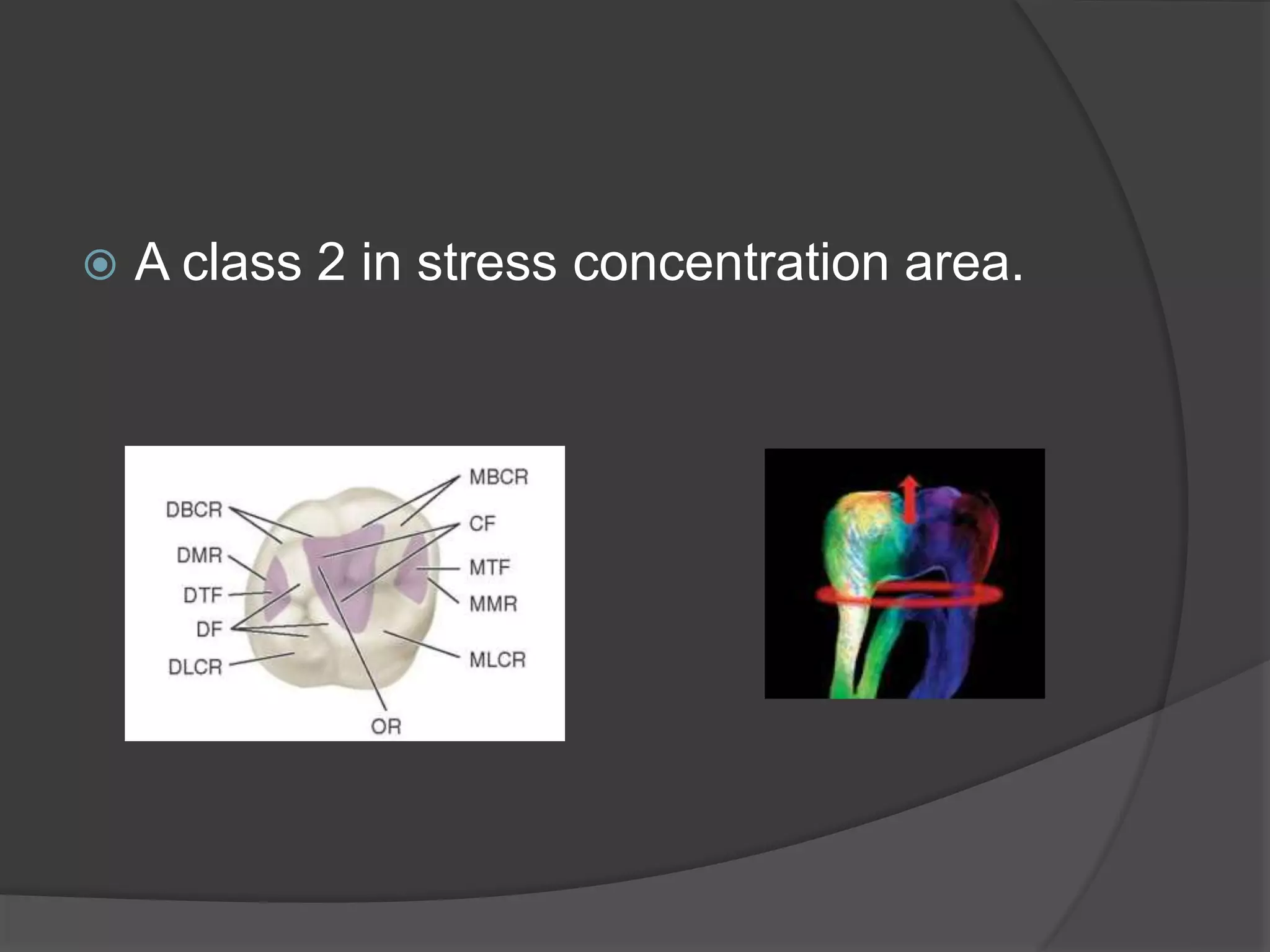  A class 2 in stress concentration area. 
 