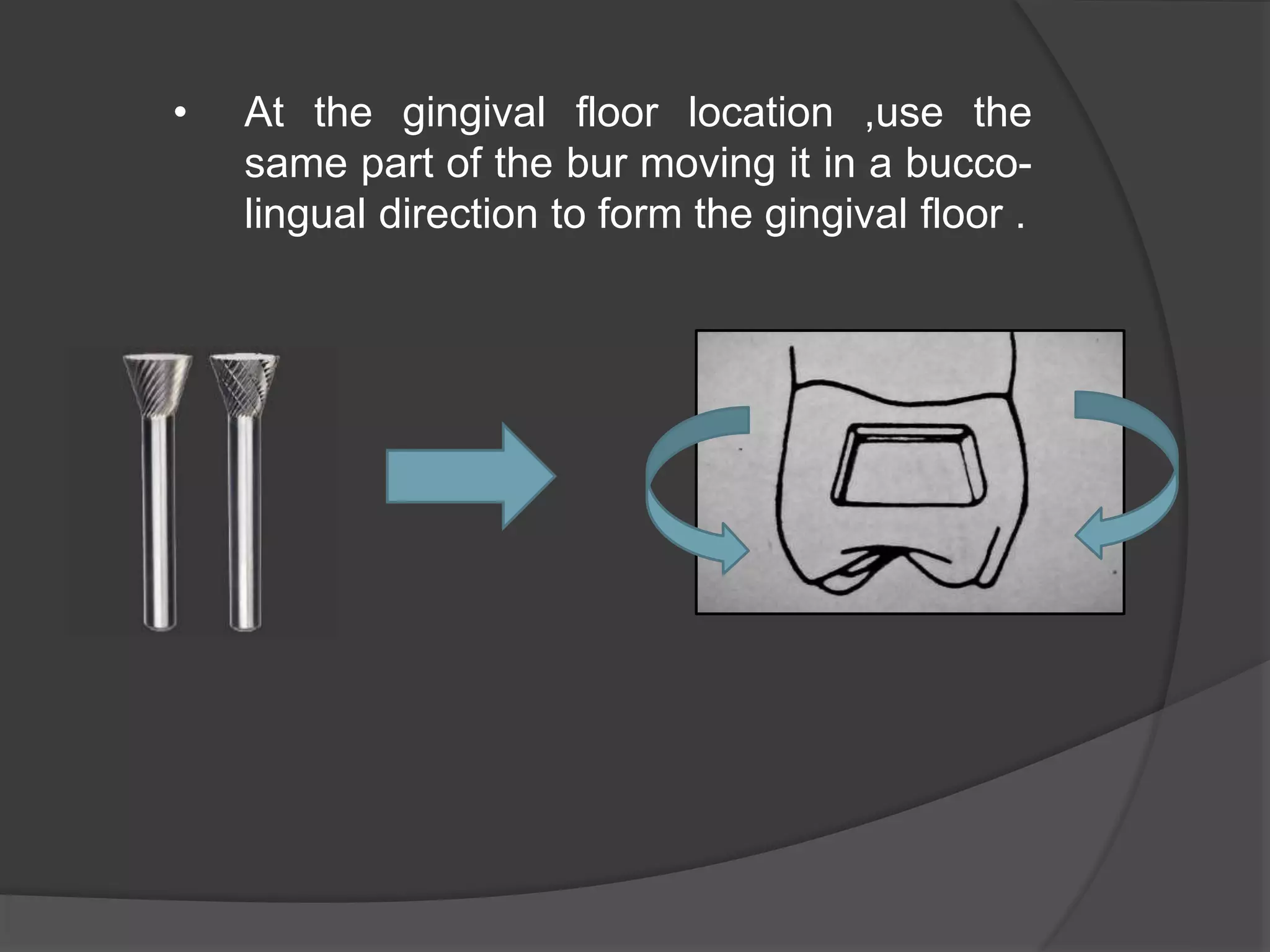 • At the gingival floor location ,use the 
same part of the bur moving it in a bucco-lingual 
direction to form the gingival floor . 
 