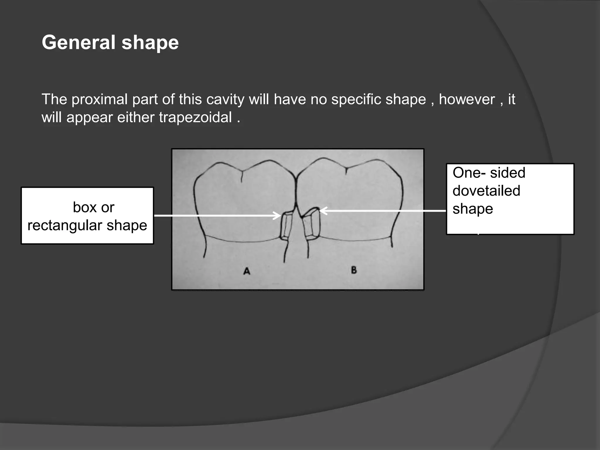 General shape 
The proximal part of this cavity will have no specific shape , however , it 
will appear either trapezoidal . 
One- sided 
dovetailed 
shapedovetailed 
shape 
a box or 
rectangular shape 
 