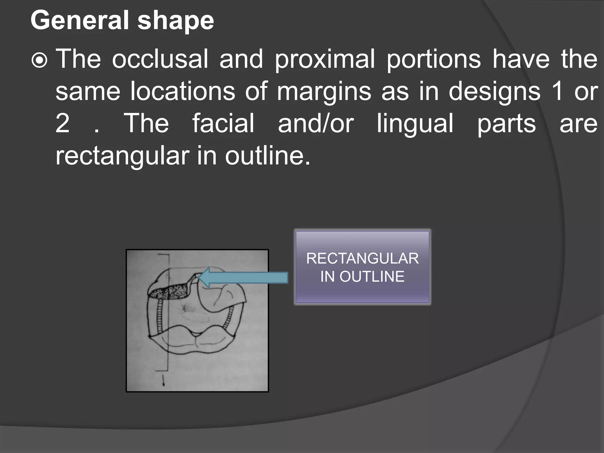 General shape 
 The occlusal and proximal portions have the 
same locations of margins as in designs 1 or 
2 . The facial and/or lingual parts are 
rectangular in outline. 
RECTANGULAR 
IN OUTLINE 
 