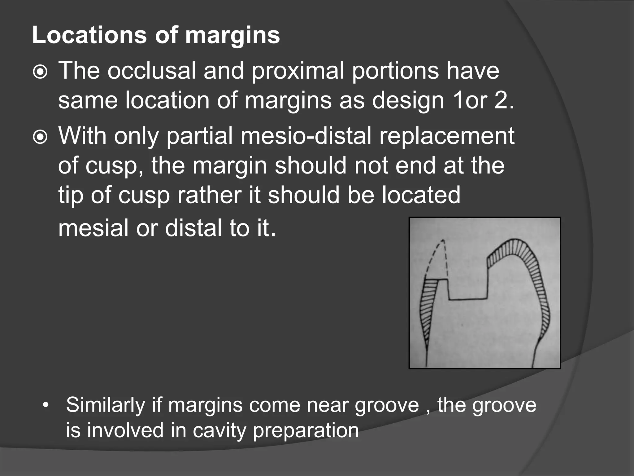 Locations of margins 
 The occlusal and proximal portions have 
same location of margins as design 1or 2. 
 With only partial mesio-distal replacement 
of cusp, the margin should not end at the 
tip of cusp rather it should be located 
mesial or distal to it. 
• Similarly if margins come near groove , the groove 
is involved in cavity preparation 
 