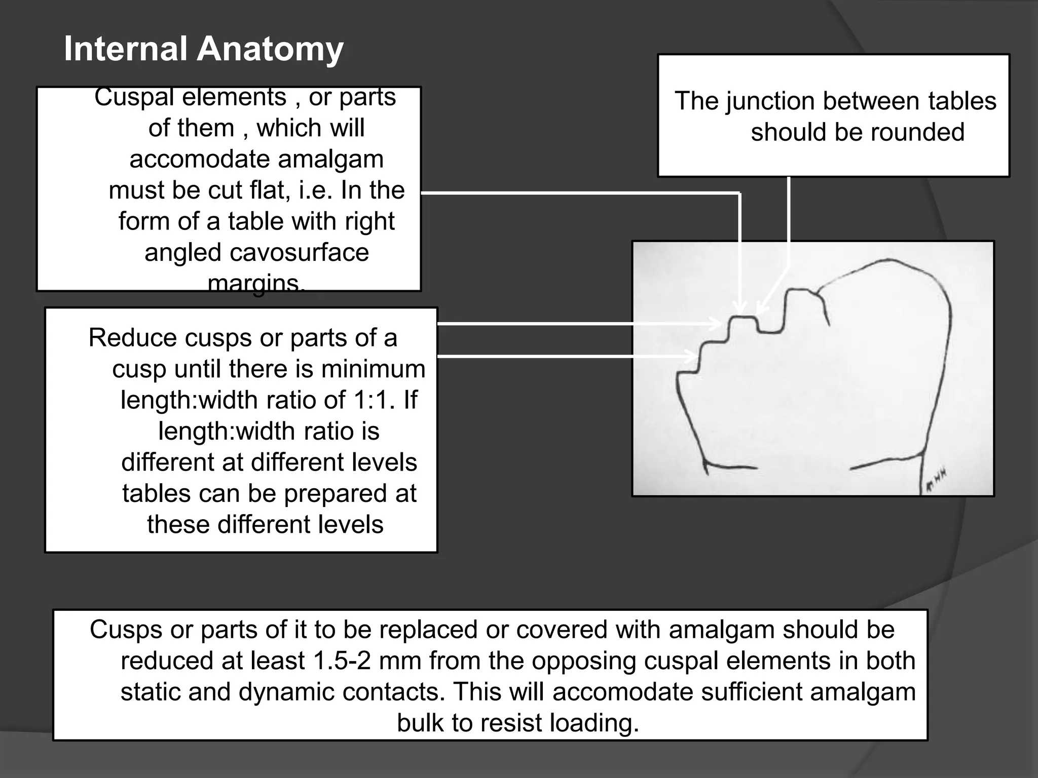 Cuspal elements , or parts 
of them , which will 
accomodate amalgam 
must be cut flat, i.e. In the 
form of a table with right 
angled cavosurface 
margins. 
Reduce cusps or parts of a 
cusp until there is minimum 
length:width ratio of 1:1. If 
length:width ratio is 
different at different levels 
tables can be prepared at 
these different levels. 
The junction between tables 
should be rounded. 
Cusps or parts of it to be replaced or covered with amalgam should be 
reduced at least 1.5-2 mm from the opposing cuspal elements in both 
static and dynamic contacts. This will accomodate sufficient amalgam 
bulk to resist loading. 
Internal Anatomy 
 