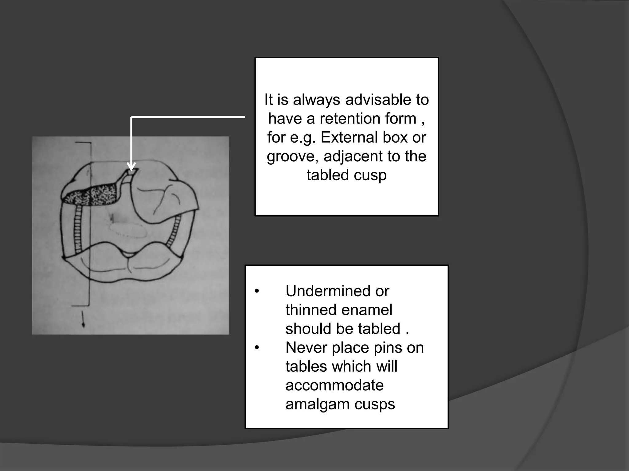 It is always advisable to 
have a retention form , 
for e.g. External box or 
groove, adjacent to the 
tabled cusp 
• Undermined or 
thinned enamel 
should be tabled . 
• Never place pins on 
tables which will 
accommodate 
amalgam cusps. 
 