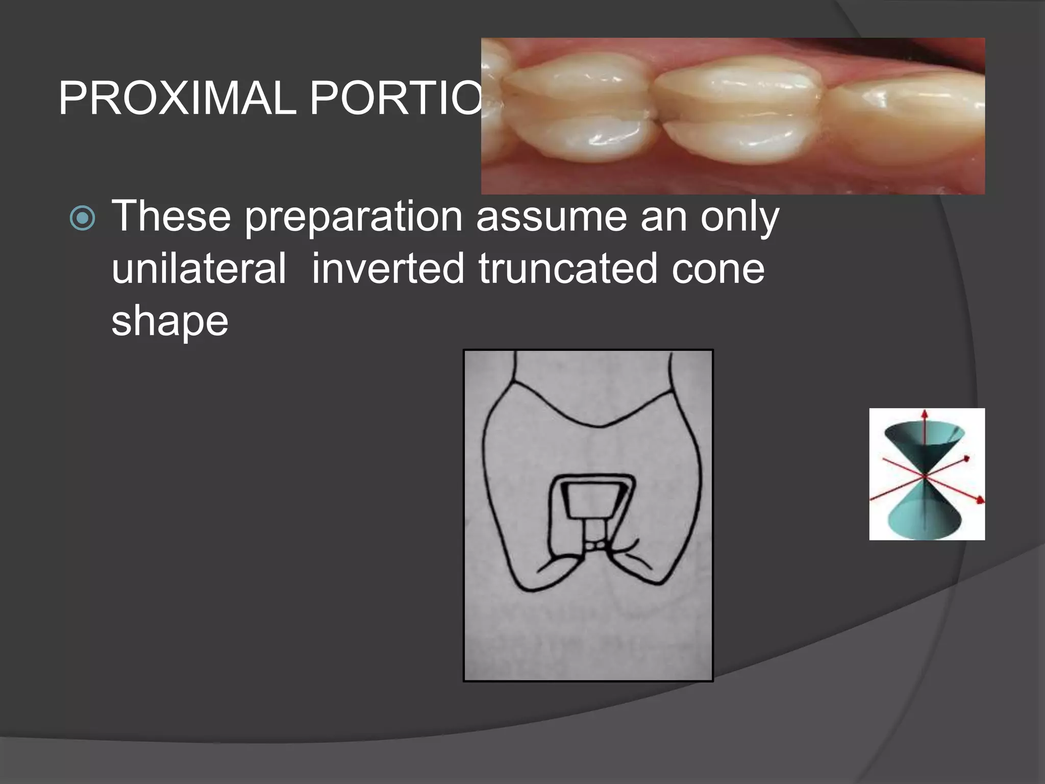 PROXIMAL PORTION: 
 These preparation assume an only 
unilateral inverted truncated cone 
shape 
 