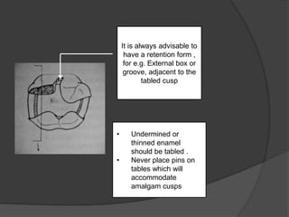 Modifications of Class 2 Cavity preparations | PPTX