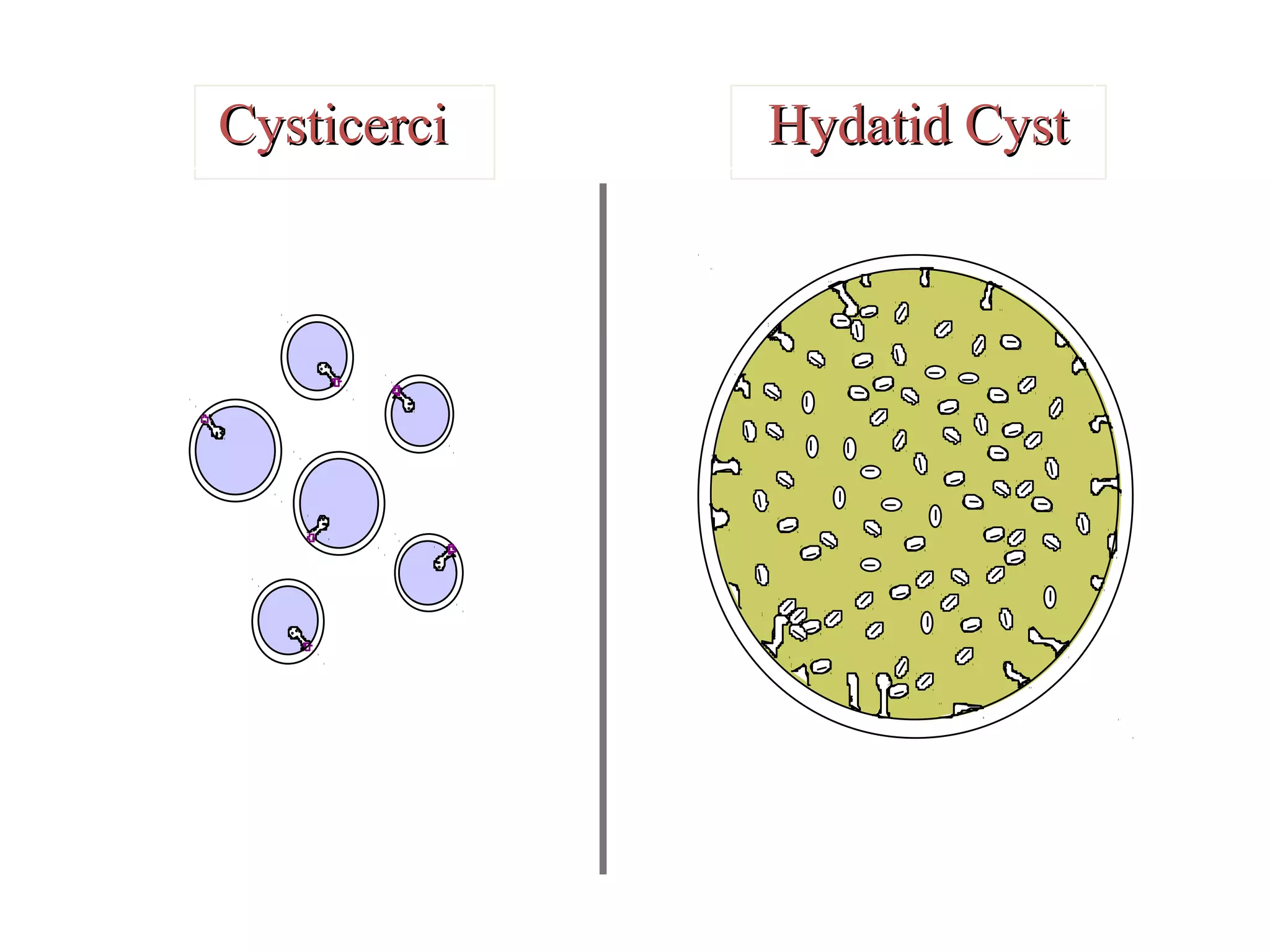 CysticerciCysticerci Hydatid CystHydatid Cyst
 
