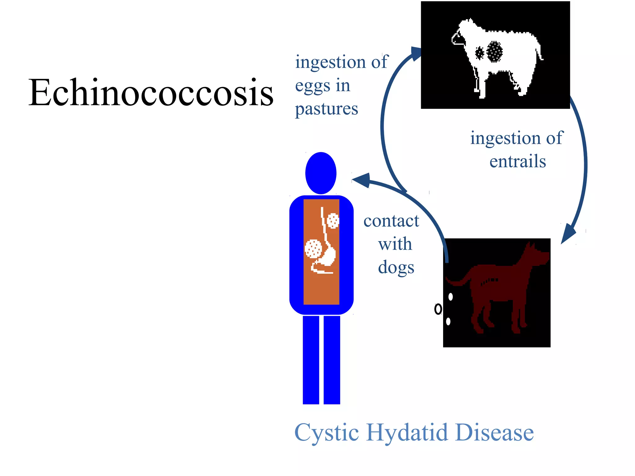 Cystic Hydatid Disease
contact
with
dogs
ingestion of
entrails
ingestion of
eggs in
pasturesEchinococcosis
 
