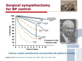 Surgical sympathectomy
for BP control
However, surgical sympathectomy was associated with significant morbidity
100
90
80
70
60
50
40
30
20
10
0
0 2 3 4 5 6 7 8 9 101
Time in Years
%Survivals
Surgical n=1266
Medical n=467
Group
3
Group
3
Group
1
Group
2
Group
4
Group
1
Group
2
Group
4
Survival rate of
normal population
Age 43
• Group 1:
Patients with persistently
elevated BP, minimal/no
eyeground changes nor
abnormalities in cerebral,
cardiac, or renal nerves
• Groups 2-4:
Patients with
increasing amounts of
cardiovascular disease
Adapted from Smithwick RH, Thompson JE. JAMA. 1953;152:1501-1504.
 