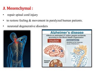 3. Mesenchymal : 
• repair spinal cord injury 
• to restore feeling & movement in paralyzed human patients. 
• neuronal degenerative disorders 
 
