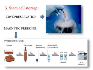 3. Stem cell storage: 
CRYOPRESERVATION 
MAGNETIC FREEZING 
 
