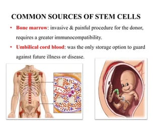 COMMON SOURCES OF STEM CELLS 
• Bone marrow: invasive & painful procedure for the donor, 
requires a greater immunocompatibility. 
• Umbilical cord blood: was the only storage option to guard 
against future illness or disease. 
 