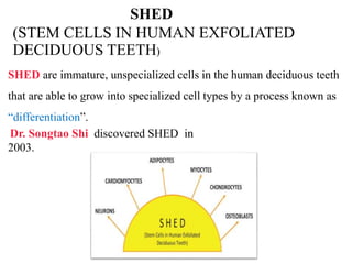 SHED 
(STEM CELLS IN HUMAN EXFOLIATED 
DECIDUOUS TEETH) 
SHED are immature, unspecialized cells in the human deciduous teeth 
that are able to grow into specialized cell types by a process known as 
“differentiation”. 
Dr. Songtao Shi discovered SHED in 
2003. 
 