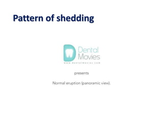 Pattern of shedding
 