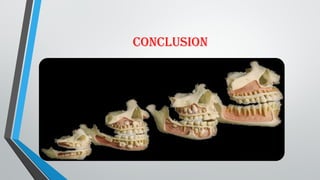 SHEDDING OF TEETH - INTRODUCTION AND HISTOLOGY | PPTX