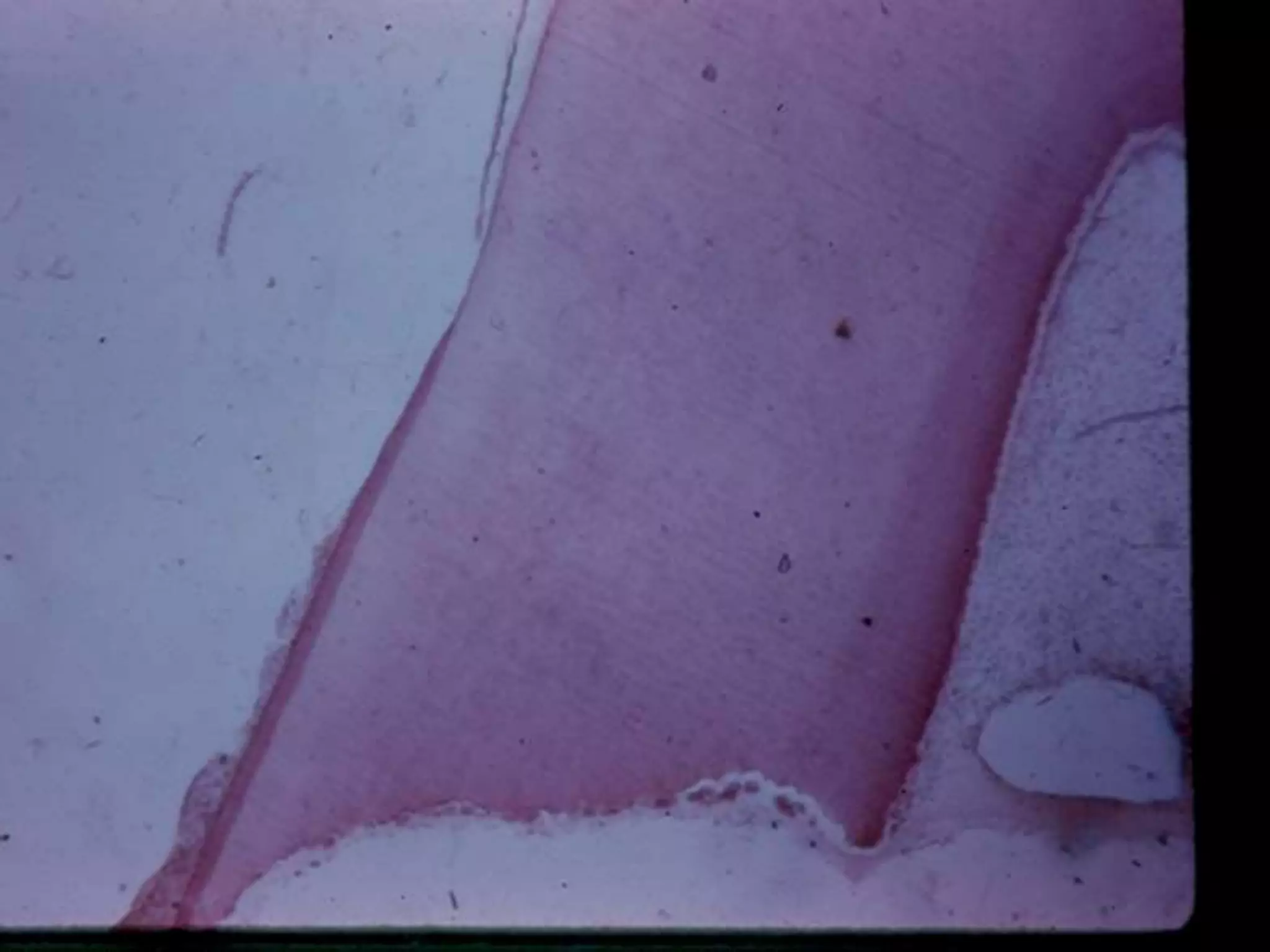 Shedding of deciduous teeth PPTX