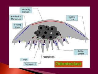 Odontoclast 
 