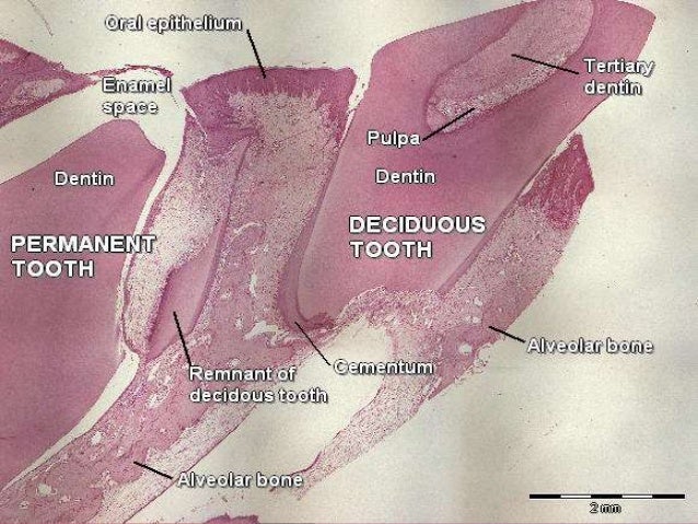 Shedding of deciduous teeth