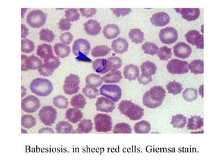 Babesiosis. in sheep red cells. Giemsa stain. 