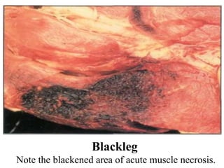 Blackleg Note the blackened area of acute muscle necrosis. 