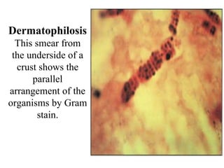 Dermatophilosis This smear from the underside of a crust shows the parallel arrangement of the organisms by Gram stain. 