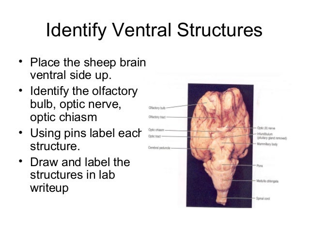 Sheep Brain Dissection