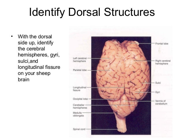 Sheep brain dissection