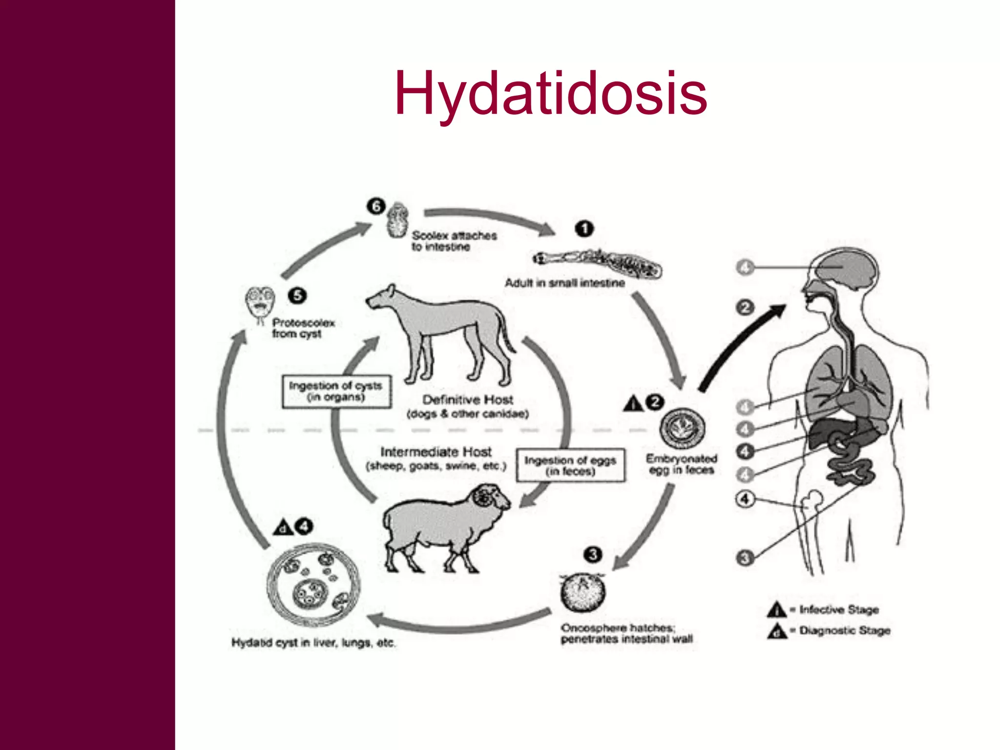 Hydatidosis

 