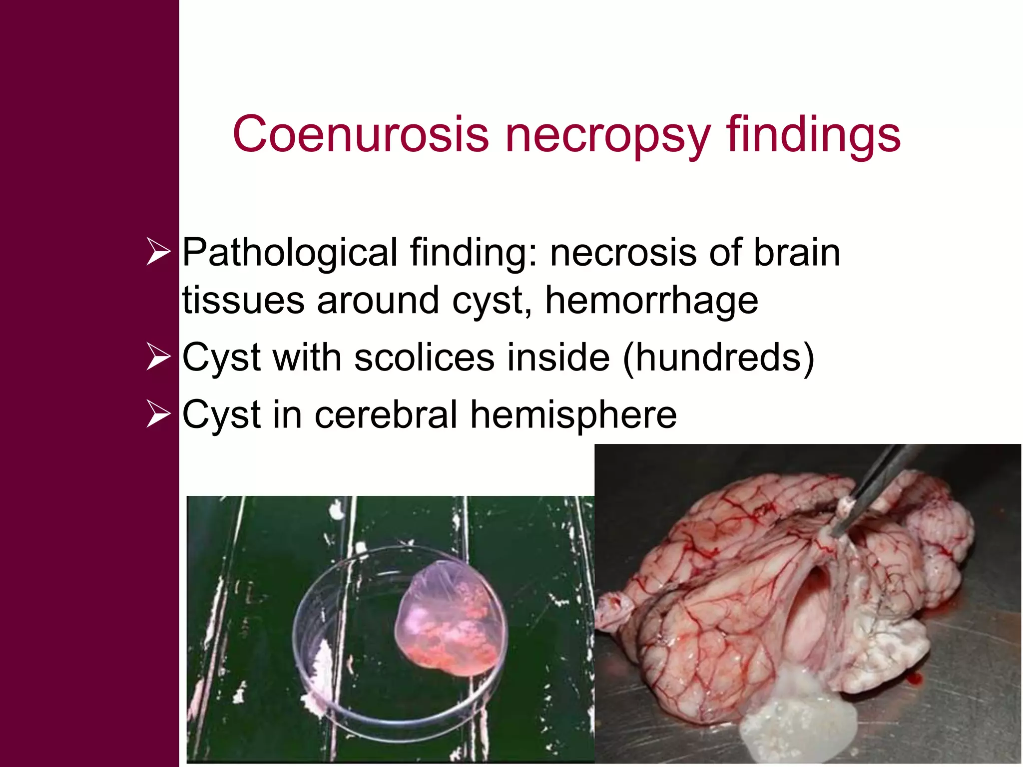 Coenurosis necropsy findings
 Pathological finding: necrosis of brain
tissues around cyst, hemorrhage
 Cyst with scolices inside (hundreds)
 Cyst in cerebral hemisphere

 
