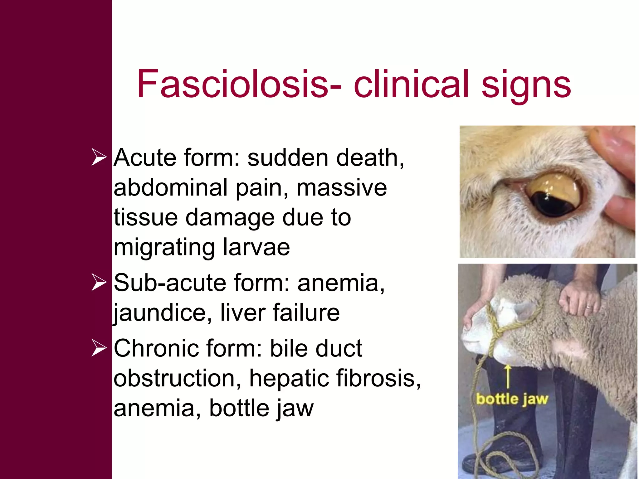 Fasciolosis- clinical signs
 Acute form: sudden death,
abdominal pain, massive
tissue damage due to
migrating larvae
 Sub-acute form: anemia,
jaundice, liver failure
 Chronic form: bile duct
obstruction, hepatic fibrosis,
anemia, bottle jaw

 