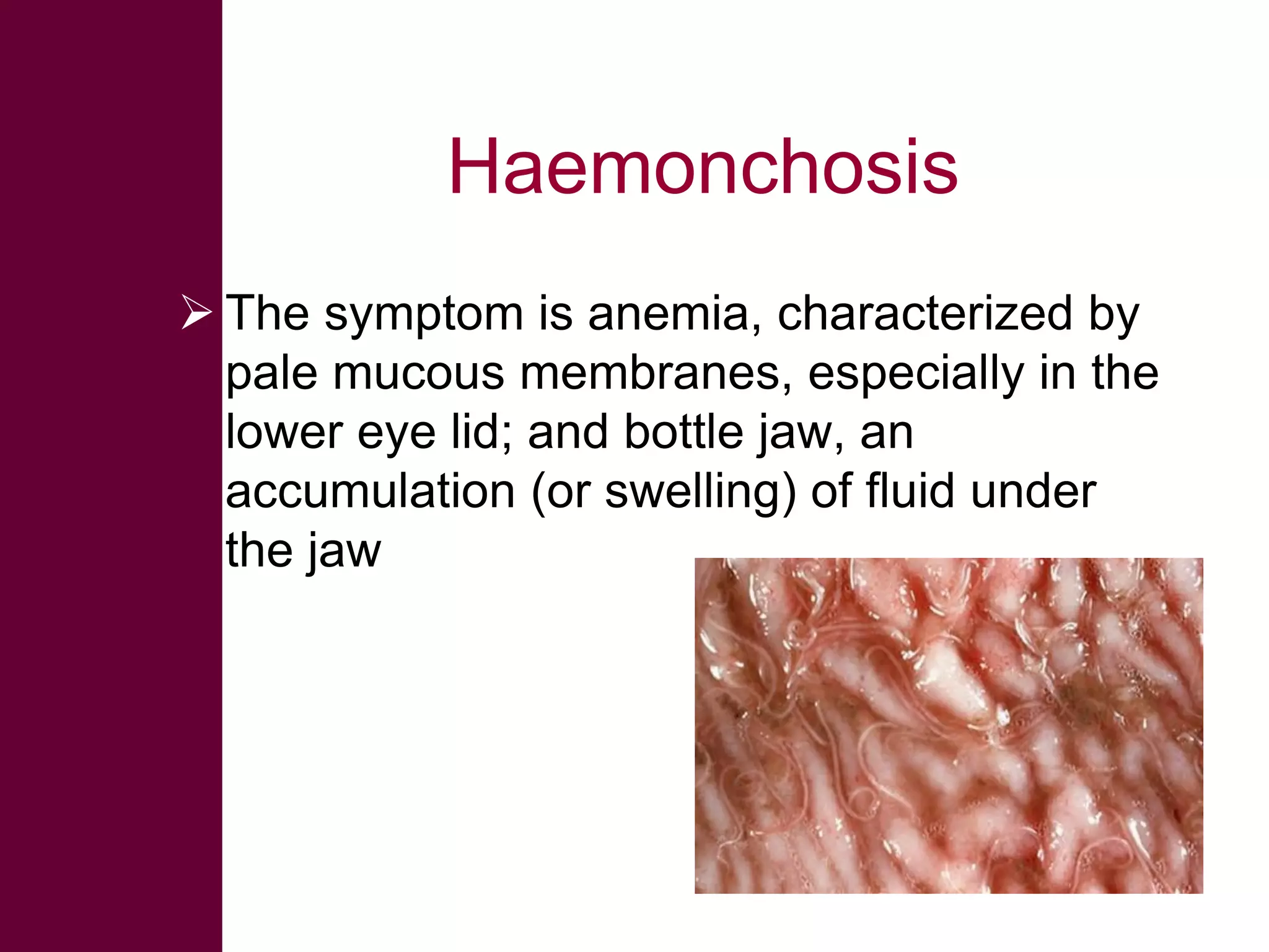 Haemonchosis
 The symptom is anemia, characterized by
pale mucous membranes, especially in the
lower eye lid; and bottle jaw, an
accumulation (or swelling) of fluid under
the jaw

 