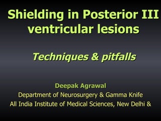 Shielding in Posterior III ventricular lesions Techniques & pitfalls Deepak Agrawal Department of Neurosurgery & Gamma Knife All India Institute of Medical Sciences, New Delhi & 