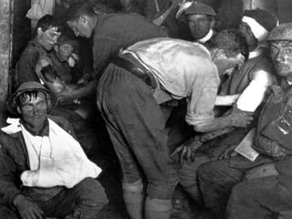 Symptoms ( #1 Fatigue) The most common stress reactions include slowing reaction time, slow thinking, cant handle stress, overacting, thousand foot gazes. 