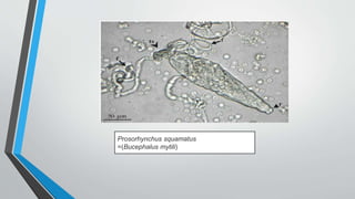 Prosorhynchus squamatus
=(Bucephalus mytili)
 